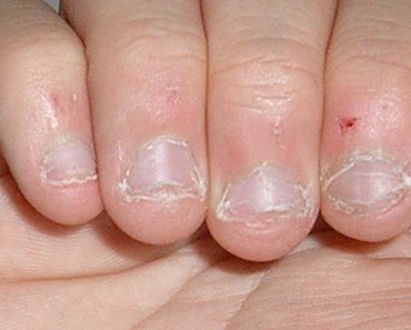 Morderse las uñas es un signo de ESTE rasgo de la personalidad 3 Morderse las uñas es un signo de ESTE rasgo de la personalidad