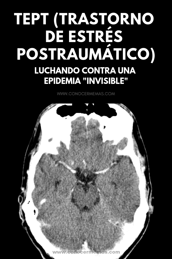 TEPT (Trastorno de estrés postraumático): Luchando contra una epidemia 'invisible'